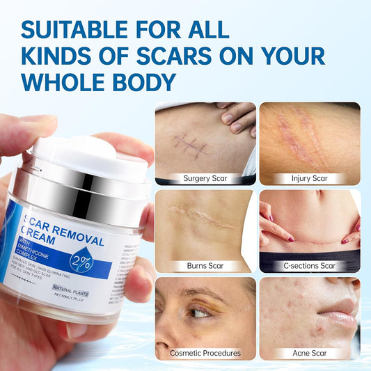 Crema Removedora de Cicatrices – Regeneración y Suavidad para tu Piel