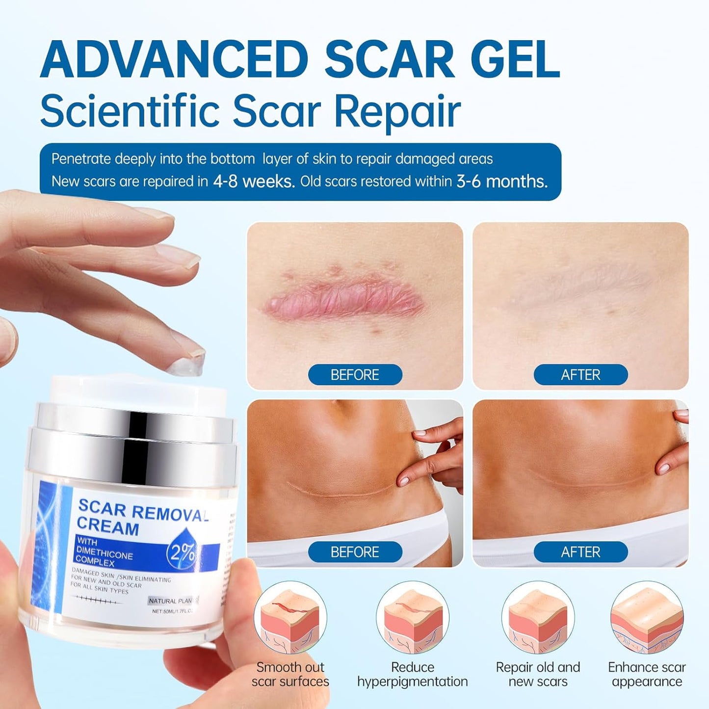 Crema Removedora de Cicatrices – Regeneración y Suavidad para tu Piel